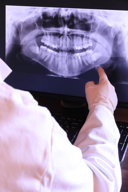 Best Emergency Dentist for Knocked-Out Tooth in Shell Rock, IA