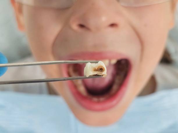 Best Pediatric Emergency Dentist in Shell Rock, IA